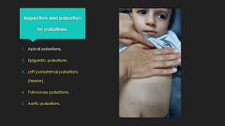 Basic Pediatric Cardiac examination [upl. by Enirol690]