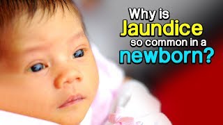 Why is Jaundice so common in a newborn [upl. by Nonac]