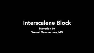 Interscalene Block  Ultrasound [upl. by Chastity]