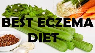 How To Cure Your Eczema Naturally  Best Eczema Diet [upl. by Hanahs]