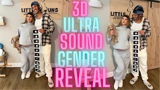 GENDER REVEAL at our 3d ultra sound [upl. by Malory126]