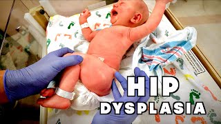 NEWBORN WITH CONGENITAL HIP DYSPLASIA Hospital Visit  Dr Paul [upl. by Aciemaj]