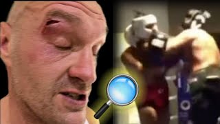 BREAKING NEWS ❗ FOOTAGE OF TYSON FURYS ALLEGED CUT EXAMINATED COUNTERPUNCHED 🚨🤔🛑 [upl. by Sofko]