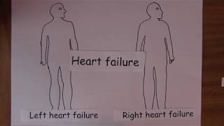 Heart Failure 7 Clinical features [upl. by Ikcir]