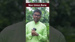 Non Union Fracture  How to Heal Non Union Fracture ayurvedadoctor fracture nonunionfracture [upl. by Lillie125]