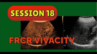 FRCR VIVACITY SESSION 18 [upl. by Fariss647]