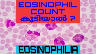 Eosinophilia  Absolute Eosinophil Count AEC Malayalam [upl. by Aramak]