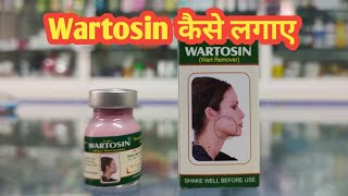 Wartosin Wart Remover l Wartosin kaise Lagaye l Price  Uses in Hindi l How to Use l [upl. by Rasec]