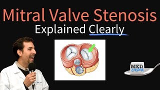 Mitral Valve Stenosis Explained Clearly  Pathophysiology Symptoms Treatment [upl. by Rauscher]