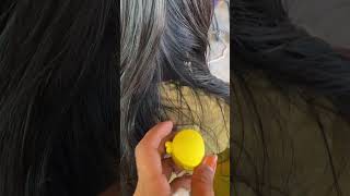 I Removed Lice and Nits from My Scalp for 30 Days Heres What Happened [upl. by Meta]