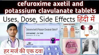 cefuroxime axetil and potassium clavulanate tablets  cefakind cv 500 mg tablet uses in hindi [upl. by Einnhoj]