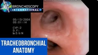 Flexible Bronchoscopy Introduction 7  Airway Inspection Tracheobronchial Anatomy [upl. by Annelise]