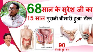 Joint Pain Relief Remedies  इस औषधि से मुझे बवासीर और हड्डी की दर्द मे 90 फ़ीसदी मिला आराम Piles [upl. by Madelyn]