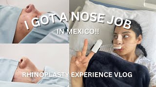 VLOG RHINOPLASTY EXPERIENSE IN MEXICO  RECOVERY PROCESS [upl. by Fritze]