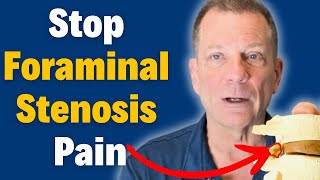 7 Steps to Beat Foraminal Stenosis Without Surgery amp Relieve Nerve Pain  Dr John Zielonka [upl. by Gorga]