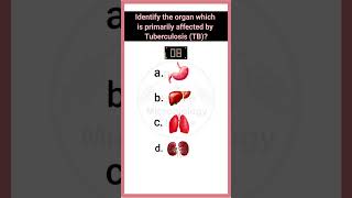 Quiz14 Bacterial disease  disease microbiology microbiologymcq bacterialdiseases pathology [upl. by Ahsirek653]