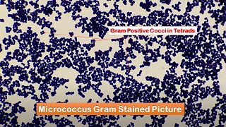 Micrococcus Gram stained smear [upl. by Arlo]