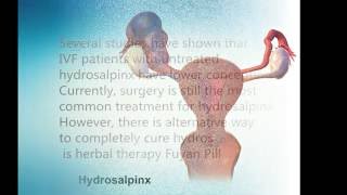 how to cure hydrosalpinx without surgery [upl. by Bloxberg122]