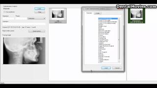 The software FACAD  Import a DICOM image file 19 [upl. by Sidoon]