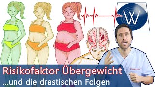 Risikofaktor Übergewicht amp Folgen Warum zuviel Körperfett Lebensjahre kostet amp Krankheiten macht [upl. by Karlyn]