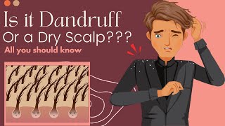 Is It Dandruff Or A Dry Scalp Heres What You Need To Know [upl. by Bronson]