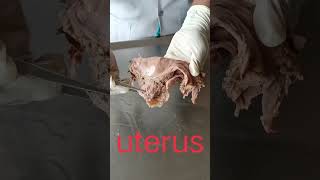 Anatomy of human Uterus uterus human dissectionshortsfeed [upl. by Nerok]