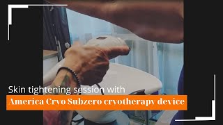 Quick upper arm skin tightening and fat burning with America Cryo localized cryotherapy [upl. by Eciened988]