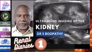 ULTRASOUND IMAGING OF THE KIDNEYS  DR S BOOPATHY  ANATOMY VARIATIONS TIPS AND TRICKS ON USG [upl. by Esiom]