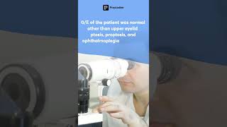 A 4 Year old with Ptosis amp a Swollen Eye Whats the condition Dailyquiz 2 [upl. by Viquelia]