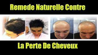 Remede Calvitie  Recette Naturelle Contre La Perte De Cheveux et Avoir Une Nouvelles Pousses [upl. by Auberon]