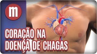 Coração na Doença de Chagas  Mulheres 260917 [upl. by Esdras508]