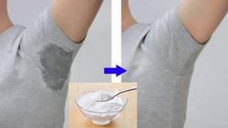 How To Stop Underarm Sweating Permanently [upl. by Laohcin]