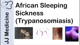 African Sleeping Sickness Trypanosomiasis  Causes Symptoms and Treatment [upl. by Nipha279]