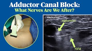 Adductor Canal Block What Nerves Are We After [upl. by Cadel]