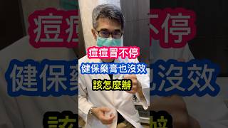 痘痘 冒不停 皮膚科醫師 說😎健保 藥膏 也沒效⁉️ 該怎麼辦❓ 吳仁欽皮膚科診所 A酸 口服A酸 艾克痘 A醇 醫皮痘 痘痘針 粉刺 過氧化苯 殺菌 抗藥性 [upl. by Marijane]