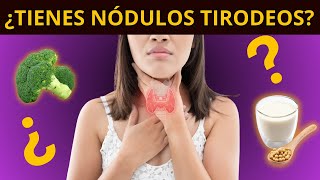 ¿TIENES NÓDULOS TIROIDEOS síntomas diagnóstico y tratamiento [upl. by Zosi895]