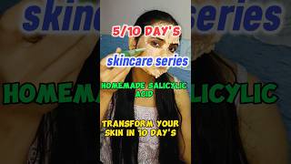 510 days homemade salicylic acid ✅skincaretips skincareytshortsindia shortfeed [upl. by Aeret]