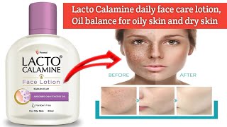 Lacto Calamine Face Lotion for Oily skin amp Dry skin  Lotion asigi kanaba khangmin nasi [upl. by Rexferd]