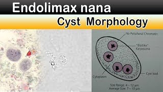 Endolimax nana Cyst Morphology [upl. by Siraved742]