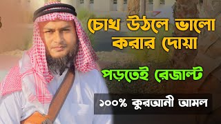 চোখ উঠলে করণীয়  চোখ ওঠা বন্ধ করার দোয়া  কোন আমল করলে চোখ ওঠা বন্ধ হবে  cokh utha bondho korar [upl. by Adnuhsed]