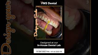 FMS Dental  Best Cosmetic Dental Clinic in Hyderabad  Smile Correction [upl. by Artim]