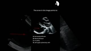 Echocardiography board practice question 12 [upl. by Eesac486]