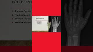 4️⃣ Types of epiphysis 🦴 anatomy anatomylectures osteology medicalstudent [upl. by Adnorrehs]