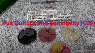 Staphylococcus aureus isolation from Pus Culture and Antibiotics Sensitivity Testing [upl. by Neelyhtak927]