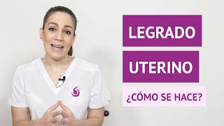 ¿Cómo se hace un legrado uterino [upl. by Neumark303]