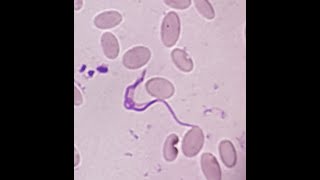 Microscopic examination of Trypanosomiasis in Camel [upl. by Rockafellow213]