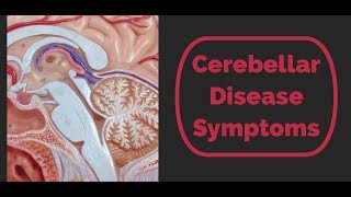 Cerebellar Disease Symptoms [upl. by Atilol213]