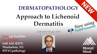 Dermatopathology Approach to Lichenoid Dermatitis  w Dr Singh [upl. by Allemaj]