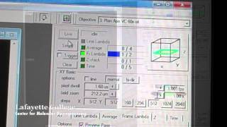 Confocal Imaging Basics [upl. by Dahlstrom]