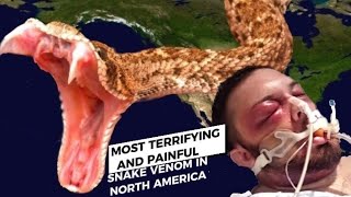 10 Most Terrifying and Painful Venomous Snake Bites In North America 🐍 [upl. by Linnette]